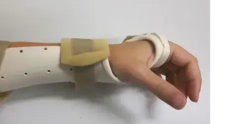splint image